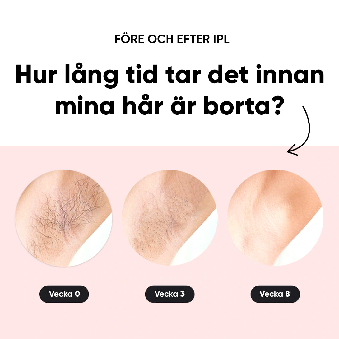 IPL - Permanent hårborttagare